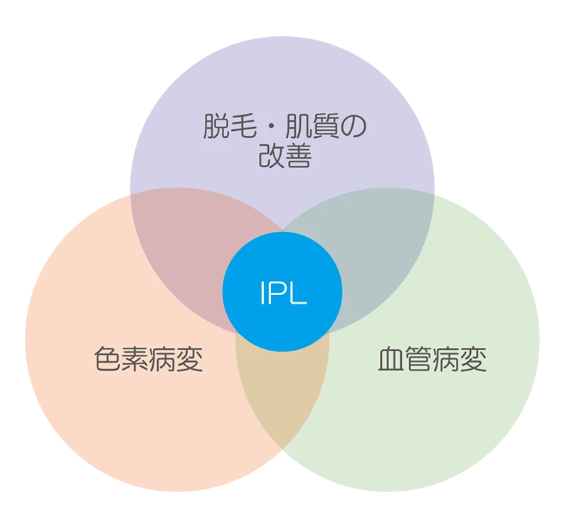 なのはな耳鼻咽喉科 IPLを表現したイラスト